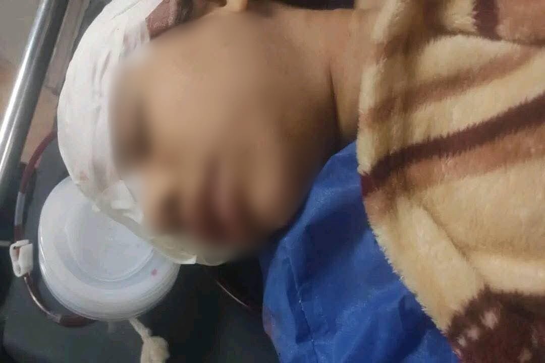 رشق القطار بالحجارة وإصابة طفلة في الجمجمة