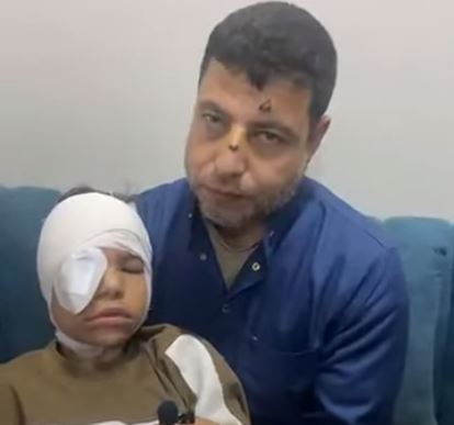 رشق القطار بالحجارة وإصابة طفلة في الجمجمة