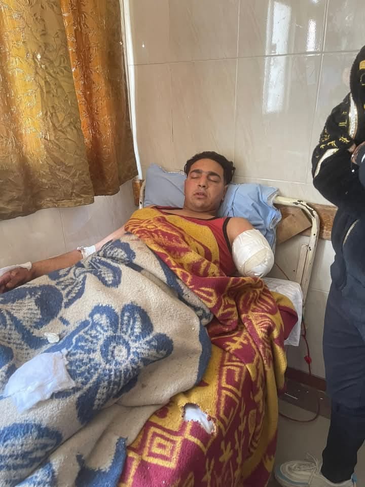 حادث هجوم النمر في سيرك طنطا..مساعد مدرب الأسود يكشف السر الحقيقي