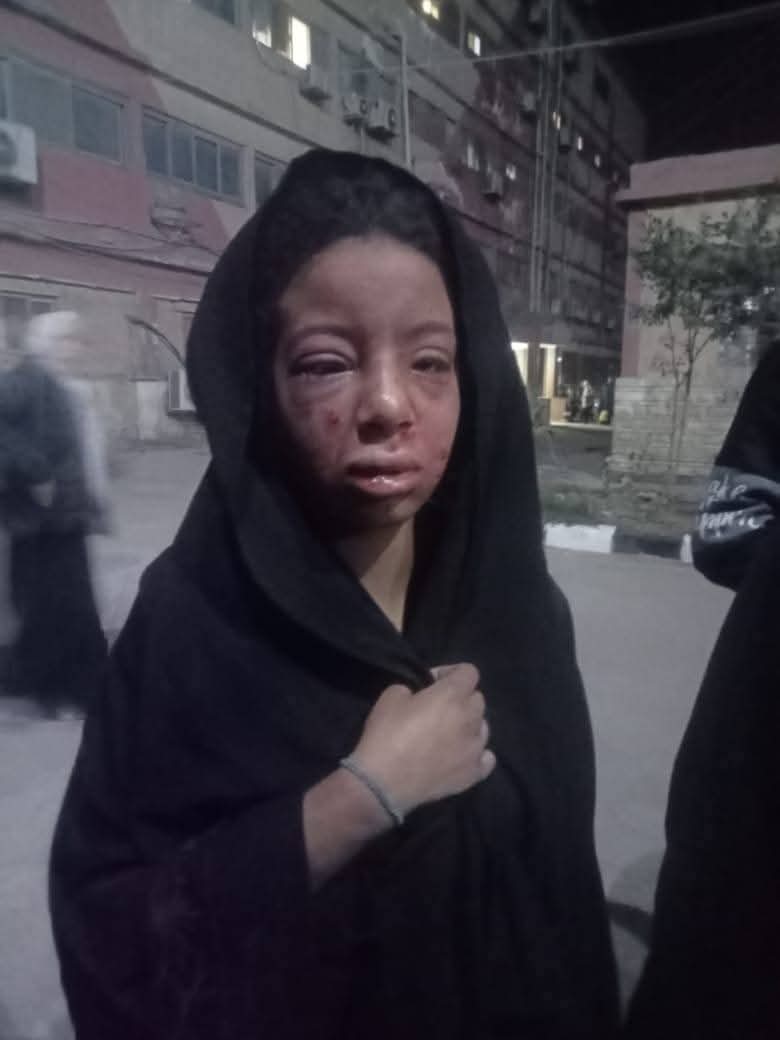 فيديو اغتصاب طفلة في بلبيس محافظة الشرقية