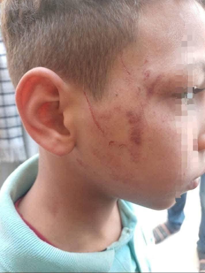  إيقاف ونقل معلمة ضربت تلميذ ابتدائي بخرطوم أنبوبة بسوهاج