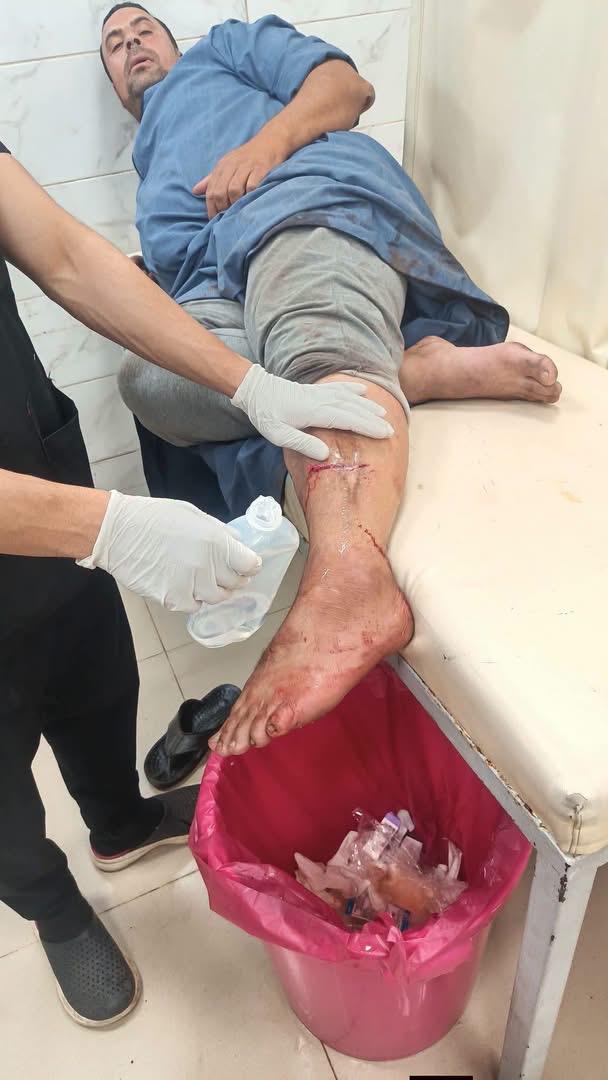 مصابو عقر الكلاب