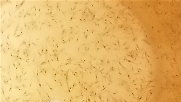 يرقات الجمبري في