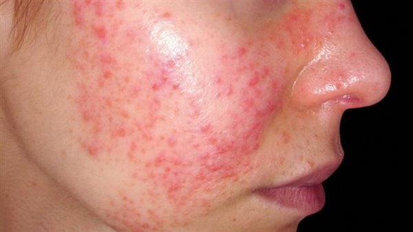 الرئيس نيوز