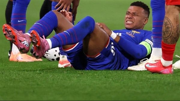 اصابة كليان مبابي