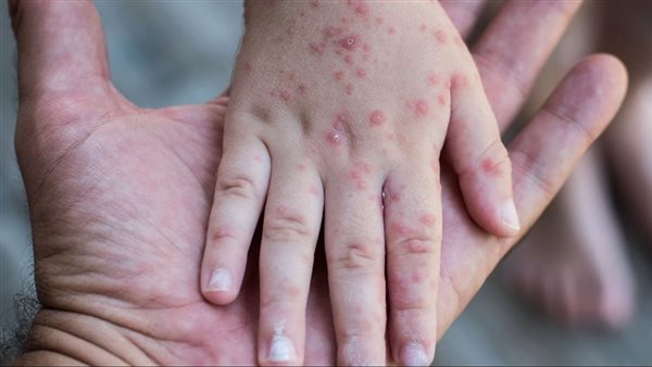 الرئيس نيوز