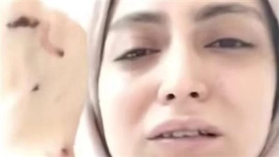 الطبيبة المعتدى عليها    